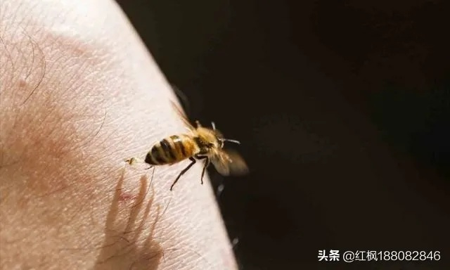 黄蜂蛰了最快消肿止疼,科学应急与家庭护理全攻略 黄蜂蛰了最快消肿止疼,科学应急与家庭护理全攻略